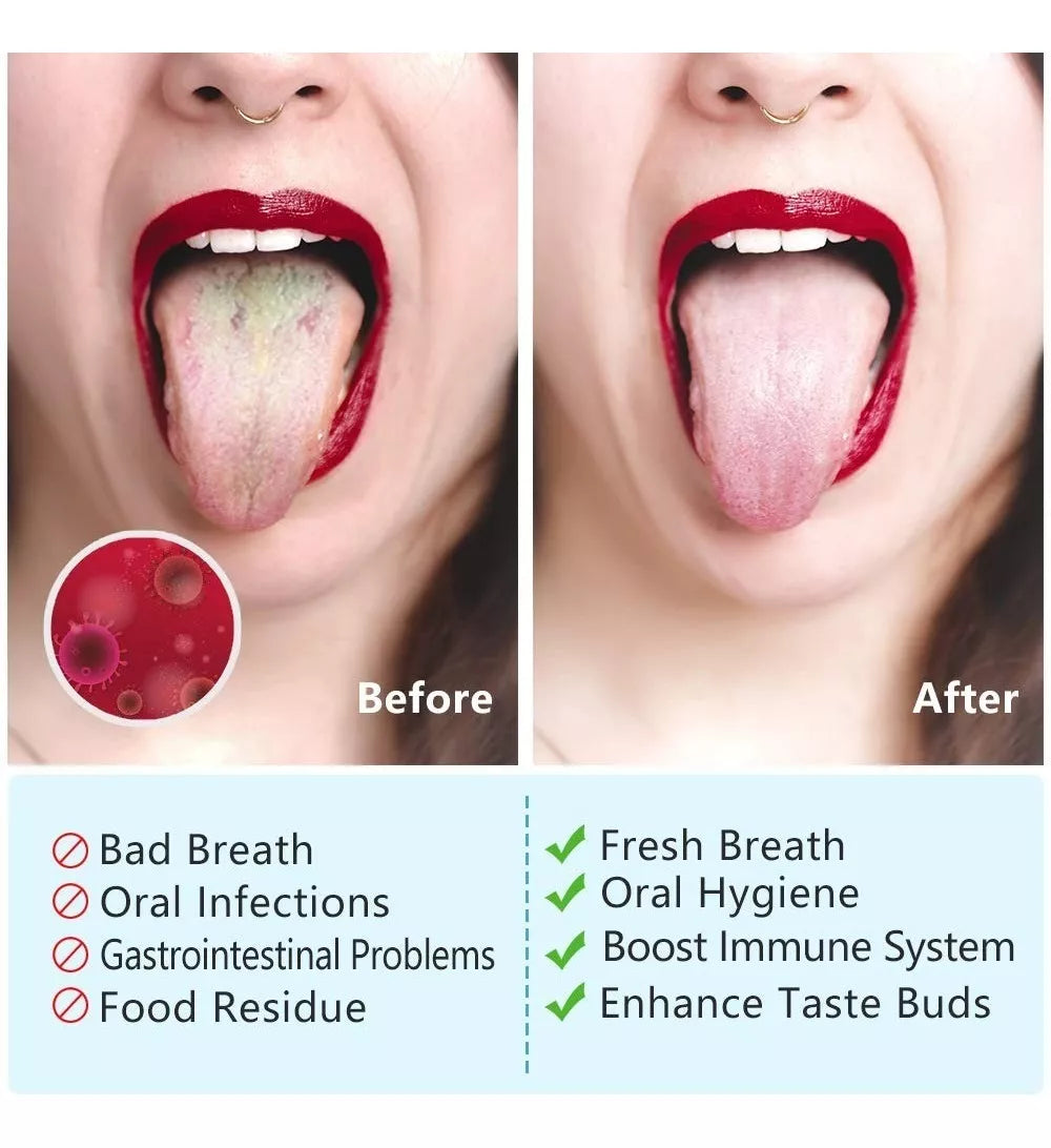 Tongue Cleaner